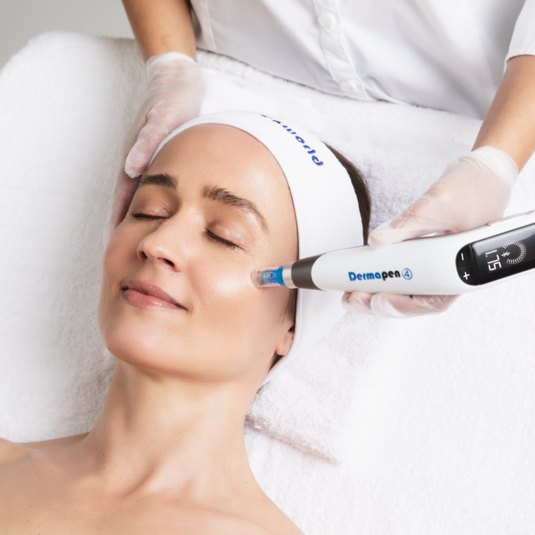 microneedling
